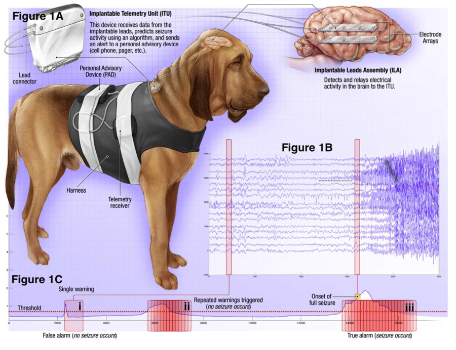 American Epilepsy Society Seizure Prediction Challenge